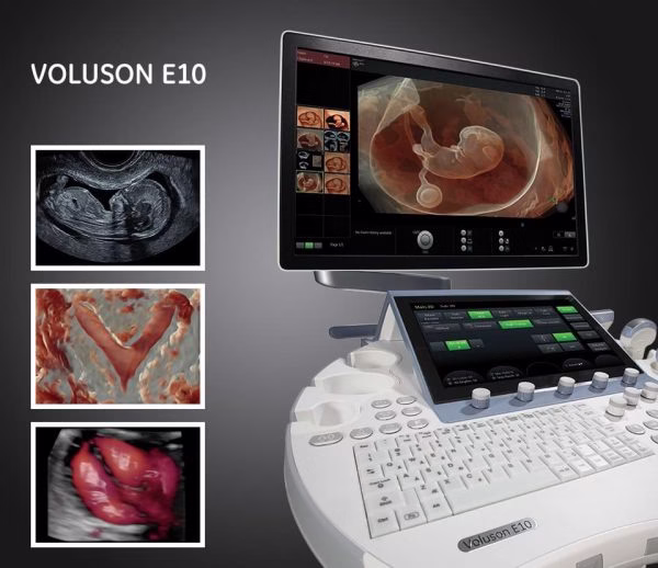 GE-Voluson-e10-600×518