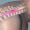 16x9_image-for-microsites_Bydon_stem-cells-for-paralysis_3863548-006-01